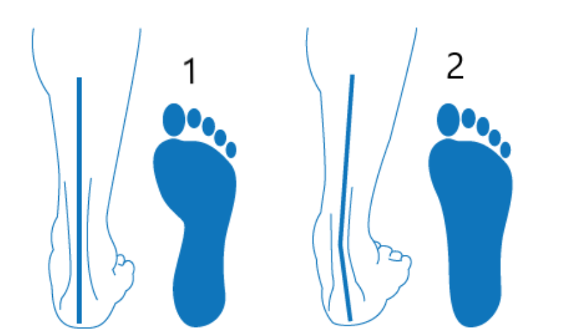 Surpronation et sous-pronation
